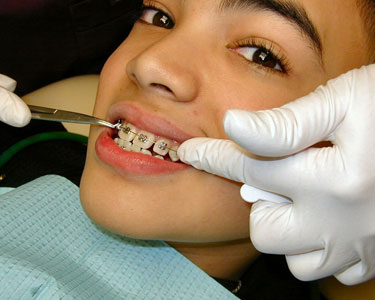 Kids San Antonio: Orthodontists - Fun 4 Alamo Kids