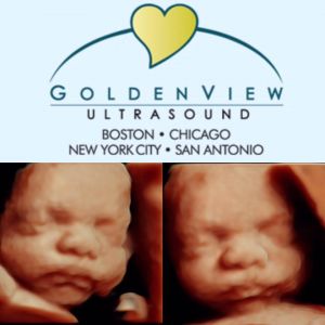 GoldenView Ultrasound San Antonio